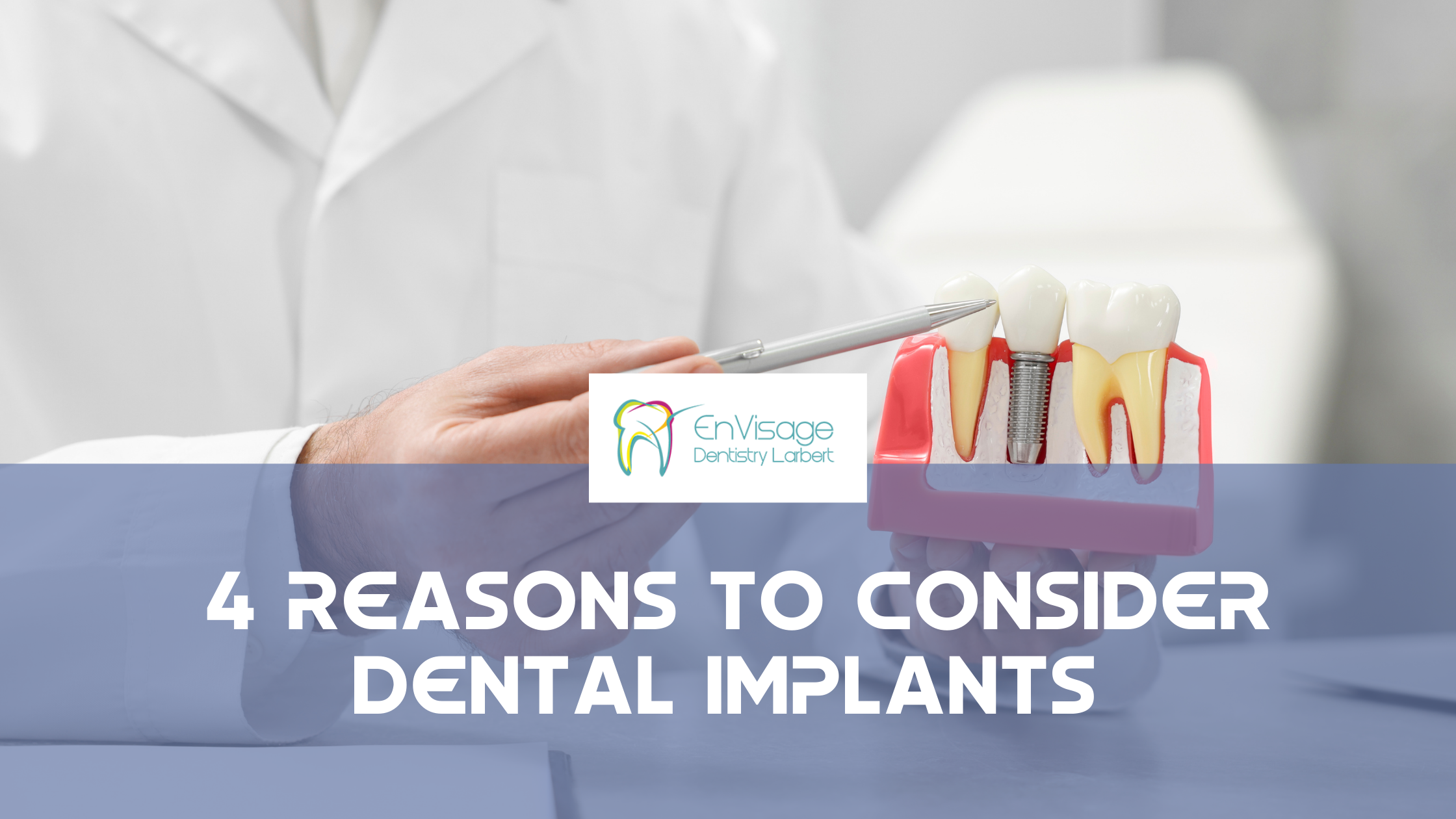 4 Reasons to Consider Dental Implants 4 Reasons to Consider Dental Implants