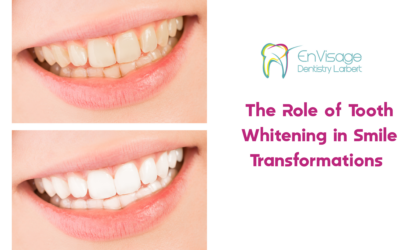 The Role of Tooth Whitening in Smile Transformations 