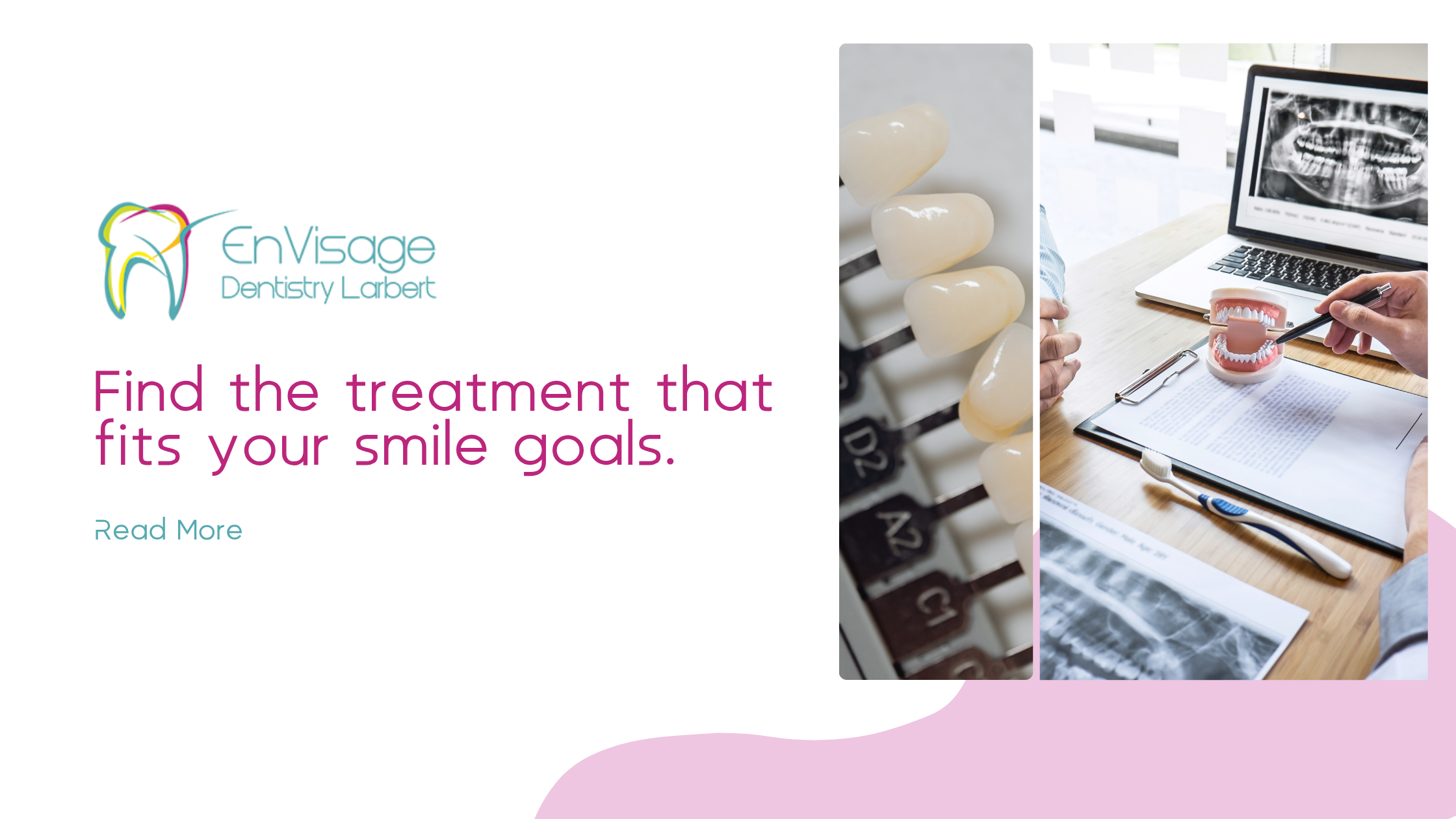 How to Choose the Right Cosmetic Dental Treatment for Your Smile Goals