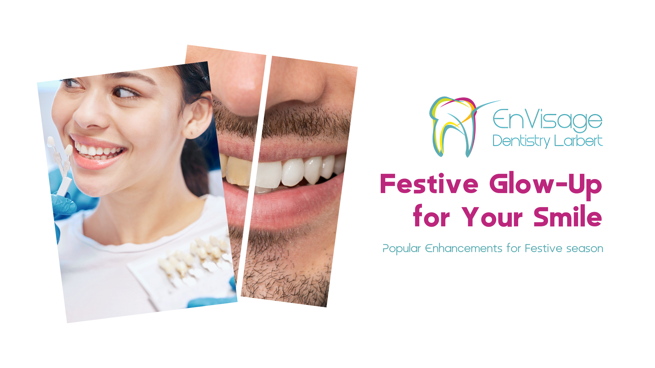The Christmas Glow-Up: Popular Smile Enhancements Before the New Year
