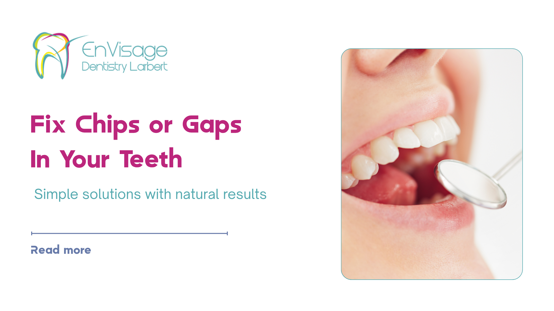 What’s the Easiest Way to Fix Small Chips or Gaps in My Teeth? | Envisage Dentistry Larbert